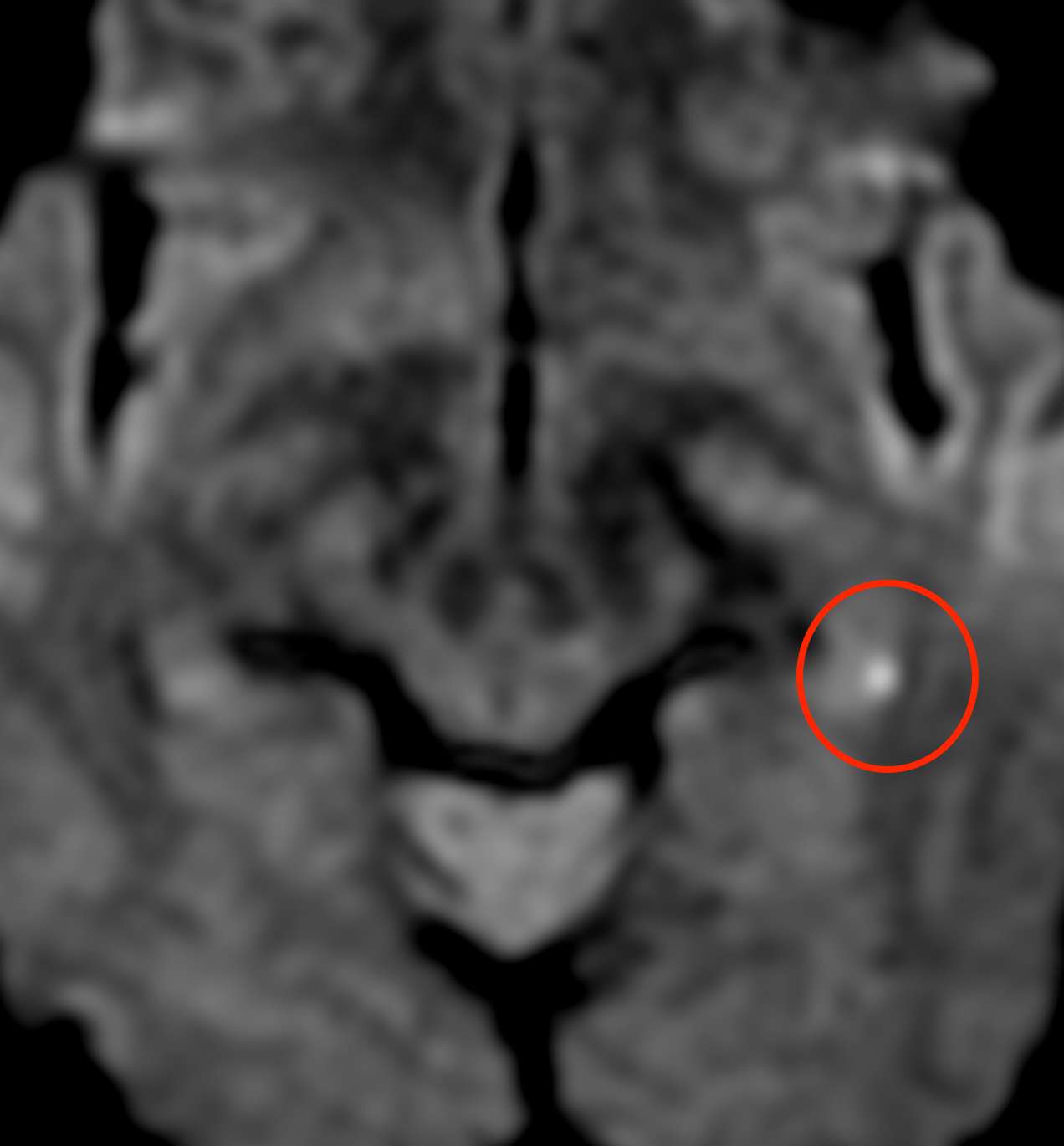 記憶がない病気